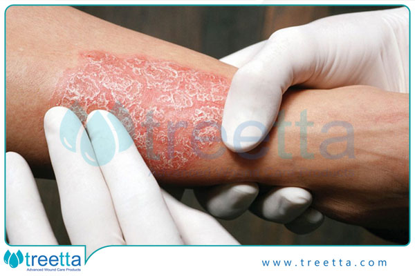 درمان انواع بیماری های پوستی رایج