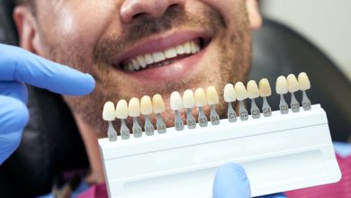 طول عمر لمینت دندان بیشتر است یا کامپوزیت؟